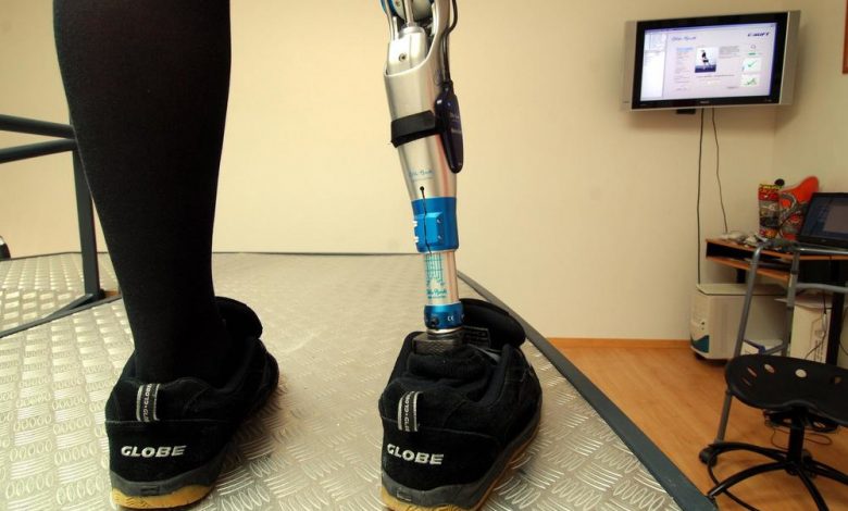 Une prothèse rétablit les sensations de patients amputés